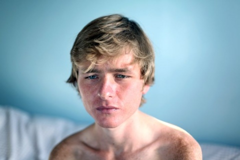 I Nagroda 53. edycji World Press Photo w kategorii: Portraits Singles, Laura Pannack, United Kingdom, Lisa Pritchard Agency for The Guardian Weekend magazine, Graham, anorexic teenager